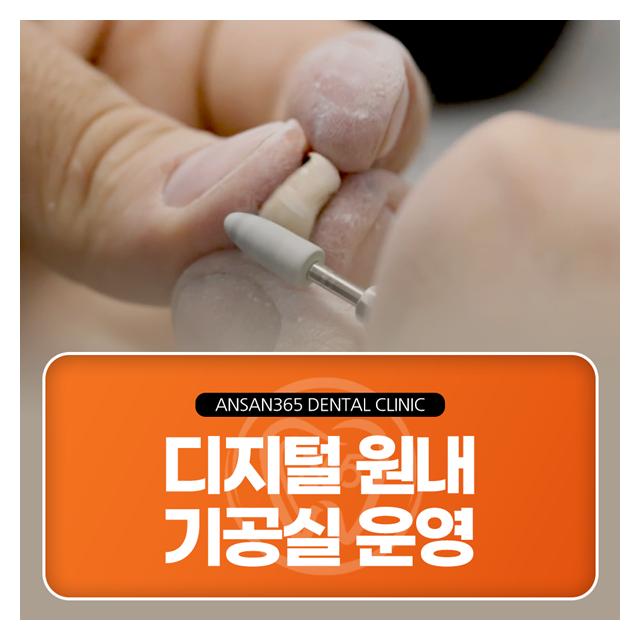 디지털 원내 기공실 운영 더 정밀하고 빠른 수술이 가능합니다.